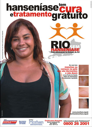 Cartaz Hansenase